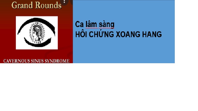 What are the symptoms and treatment for Hội chứng xoang hang?